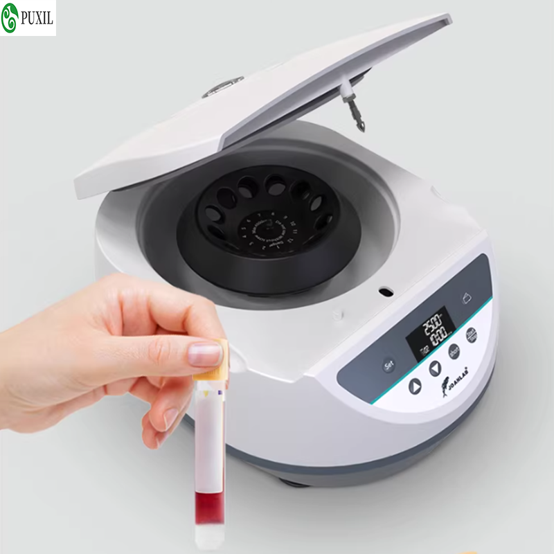 Centrífuga de plasma AB para l - Blood Collection Tube avaliação e preço
