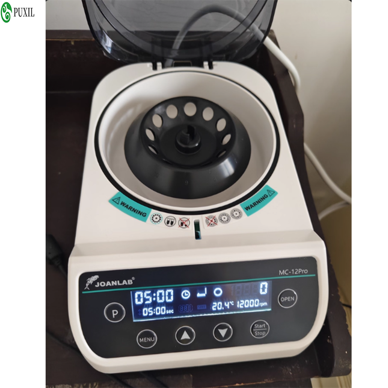 Centrífuga de plasma AB para l - Blood Collection Tube avaliação e preço